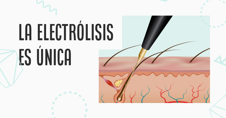 Electrólisis, único método de depilación permanente