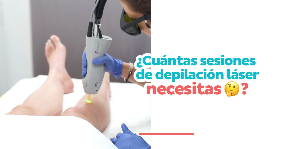 ¿Cuántas sesiones necesitas?