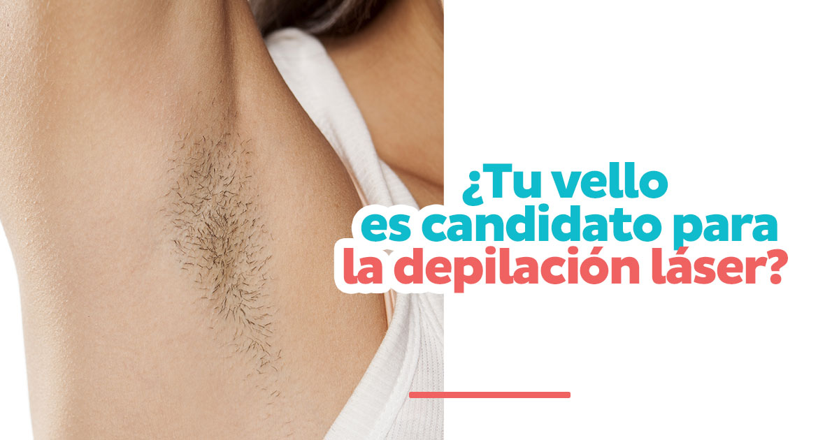 ¿Tu vello es candidato?